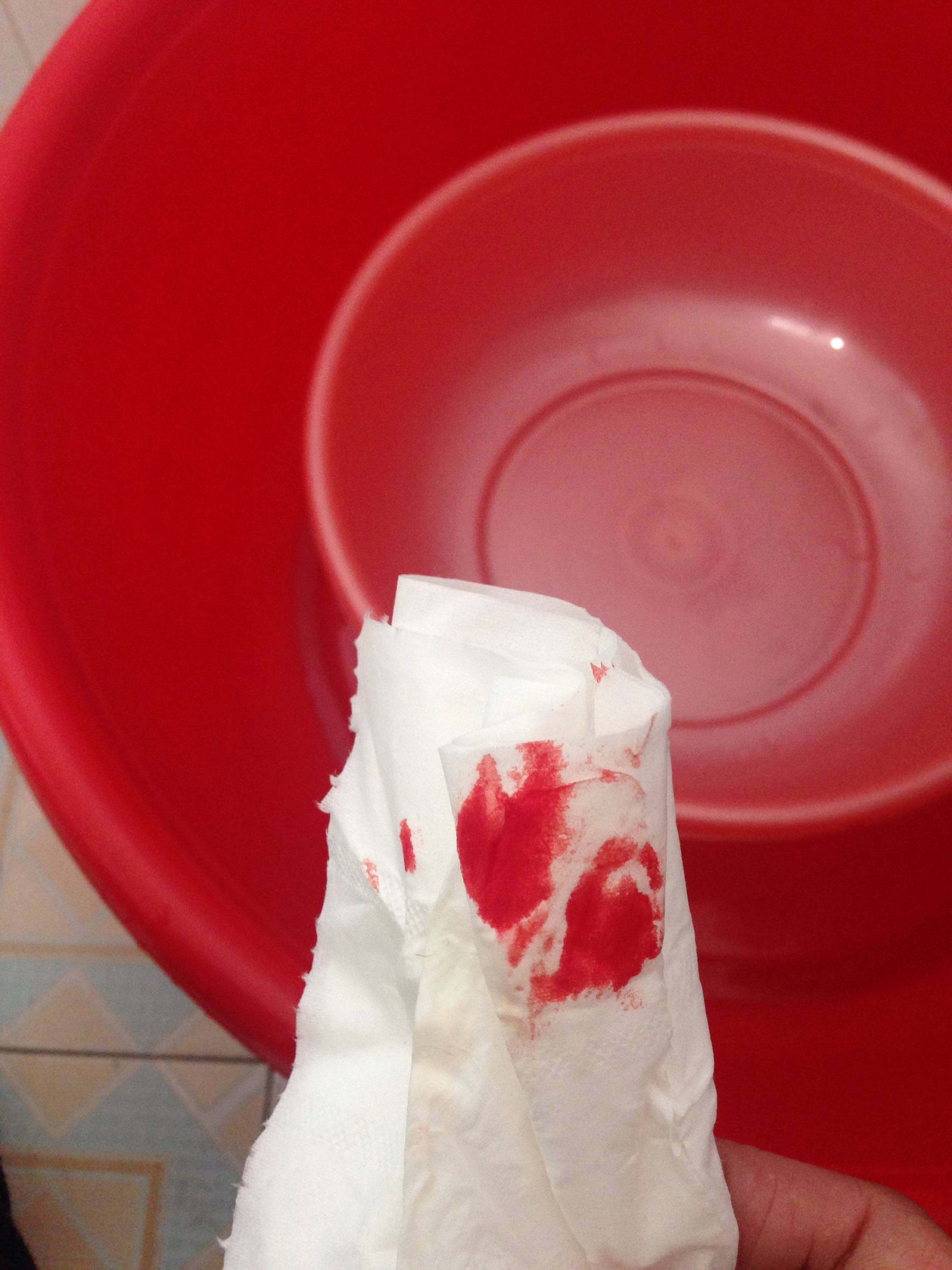 Nhìn màu sắc kinh nguyệt để đoán bệnh tình của mình 6